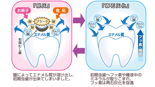 歯の脱灰と再石灰化